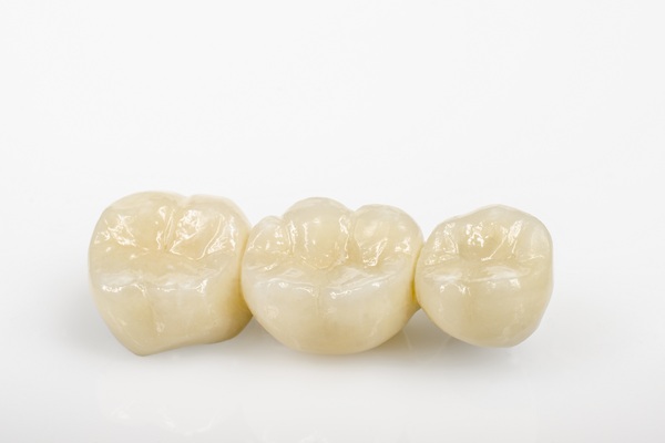 Caring For Your Dental Bridge: Tips For Longevity