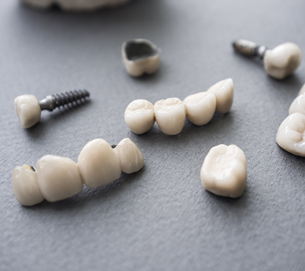Los Alamitos The Difference Between Dental Implants and Mini Dental Implants