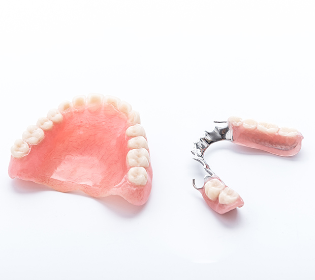 Los Alamitos Partial Dentures for Back Teeth