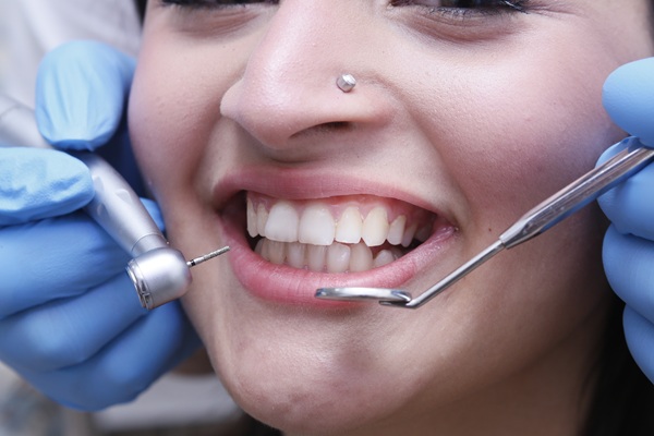 Take Home Professional Teeth Whitening Options From Your General Dentist