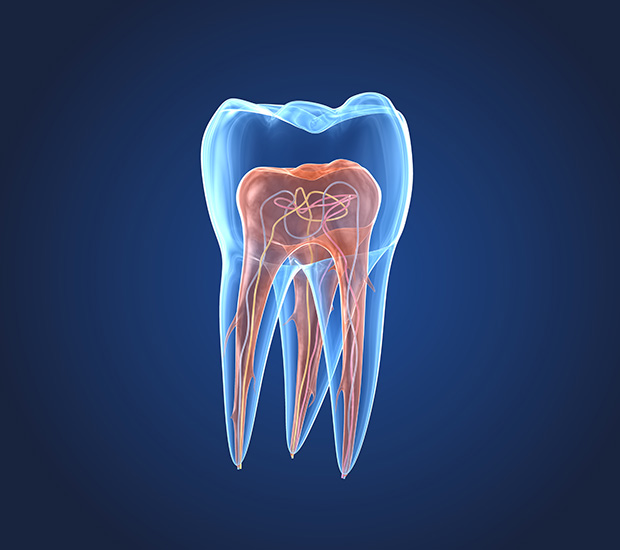 Los Alamitos What is an Endodontist